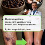 Ulei de Usturoi și Cuișoare: O Alternativă Naturală pentru Durerile de Picioare cf-featured-34